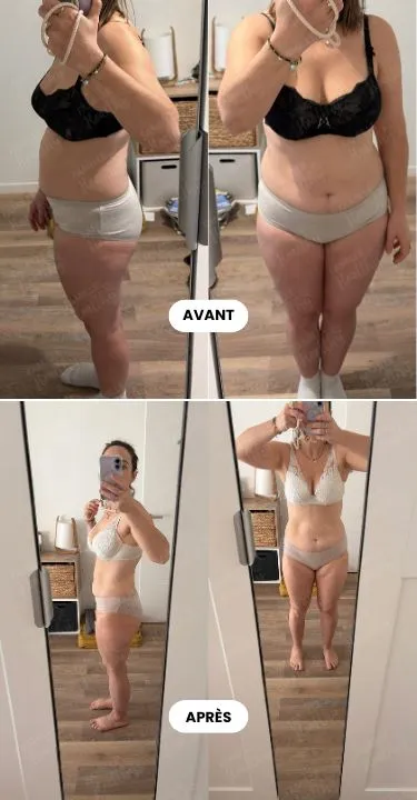 Avant / Après